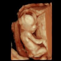 Futuras mamas octubre 2020 - 1