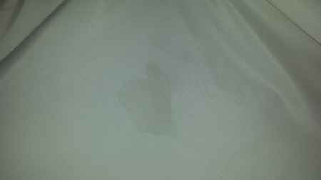 manchas vestido