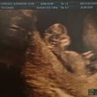 Ayuda con método ramzi: niño o niña? - 1