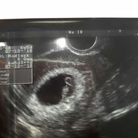 Mamas octubre 2018 - 1