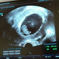 Futuras mamás Octubre 2018!!! - 1