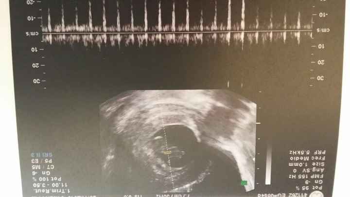 Mamis julio 2017 - 1