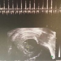 Mamis julio 2017 - 1