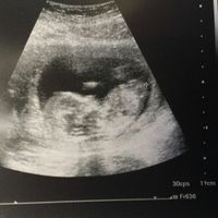 Mamis julio 2017 - 1