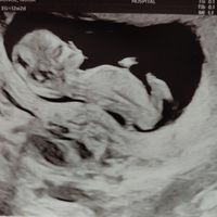 Futuras mamás Junio 2020 - 1