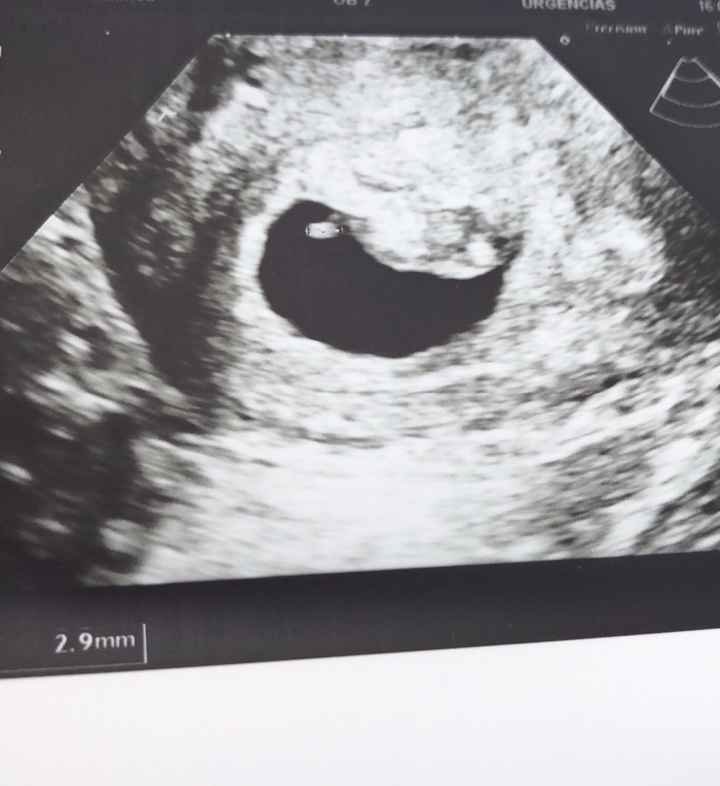 Futuras mamás Agosto 2020 - 1