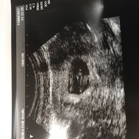 ¡nuevo! futuras mamis marzo 2018 - 1