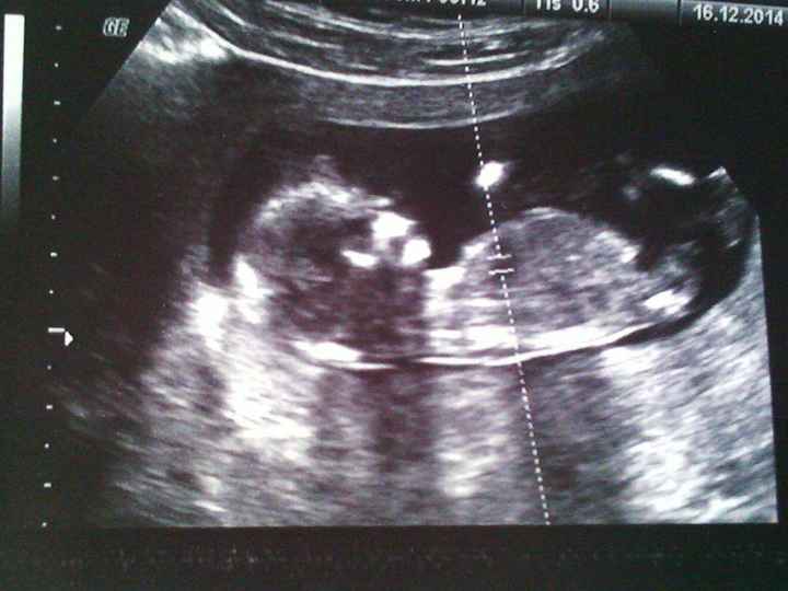 El consultorio de Lita para futuras mamis - 2