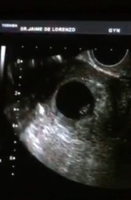 Futuras mamis octubre 2016 - 1
