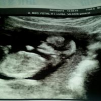Que os parece niño o niña - 2