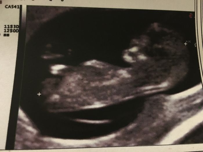 Mamis julio 2017 - 1