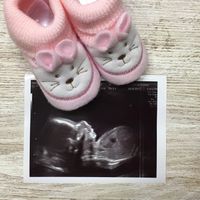 Mamis julio 2017 - 1
