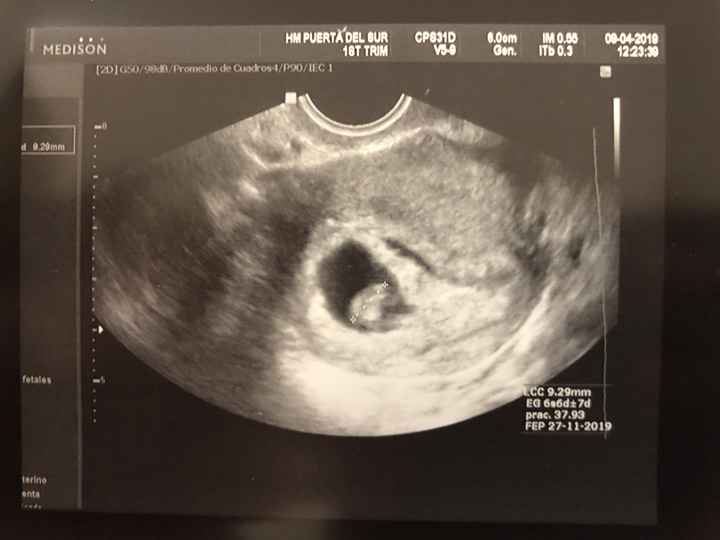 Ayuda con método ramzi: niño o niña? - 1