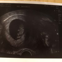Futuras mamis diciembre 2019 oficial - 1
