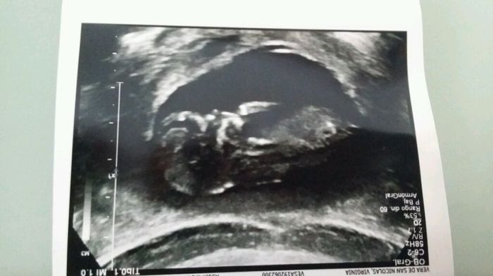 Futuras mamas julio 2016 - 1