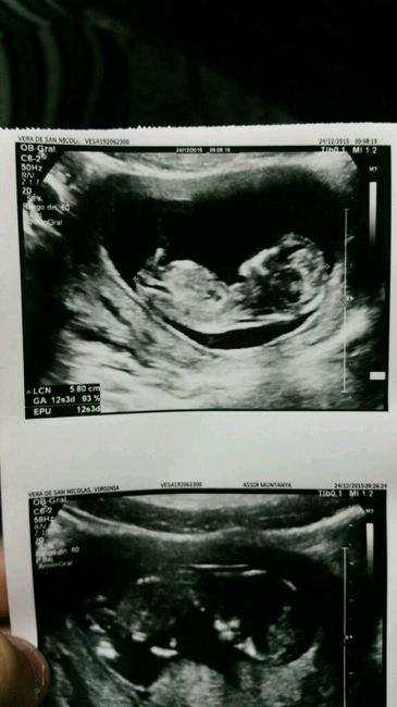 Futuras mamas julio 2016 - 2
