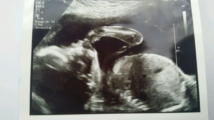 Futuras mamas julio 2016 - 1