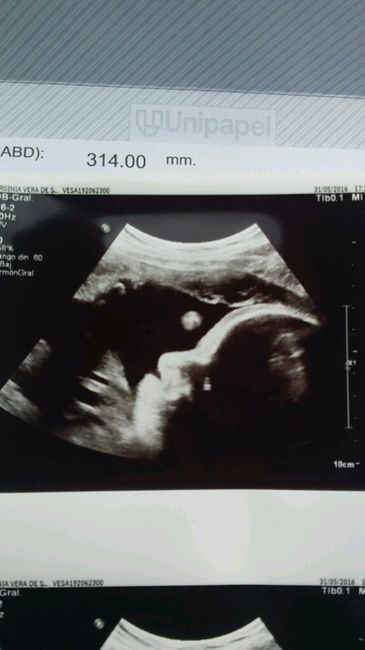 Futuras mamas julio 2016 - 1