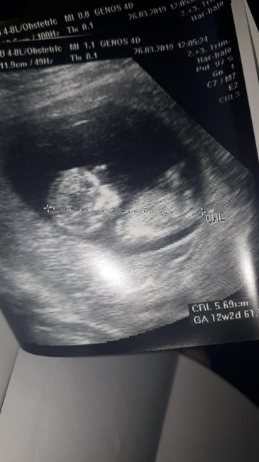 Niño o niña
