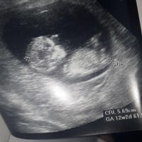Niño o niña