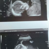 Futuras mamis diciembre 2017 - 1