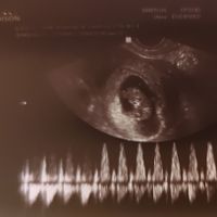 Futuras mamás octubre 2021 - 1