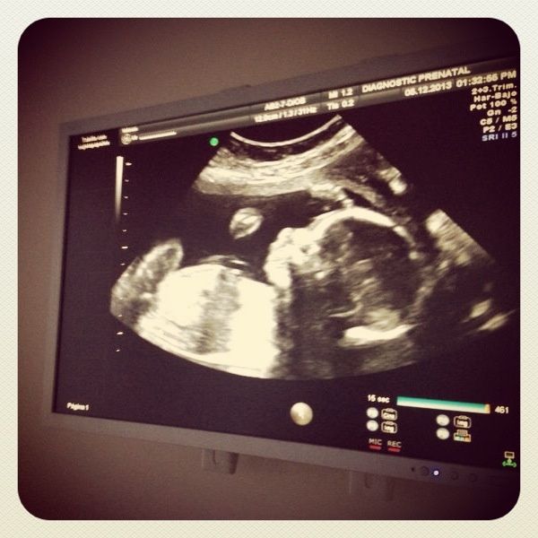 21 weeks