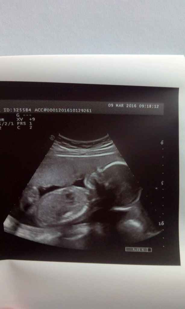 Futuras mamas julio 2016 - 1