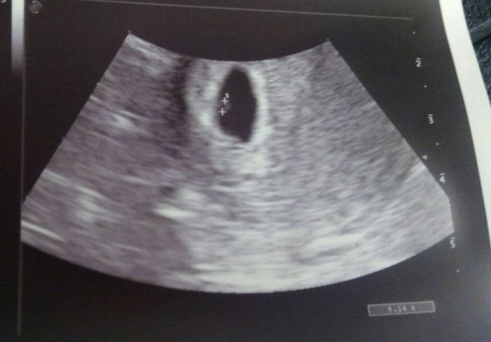 Futuras mamas julio 2016 - 1