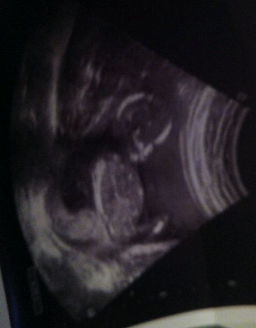 Futuras mamas julio 2016 - 1