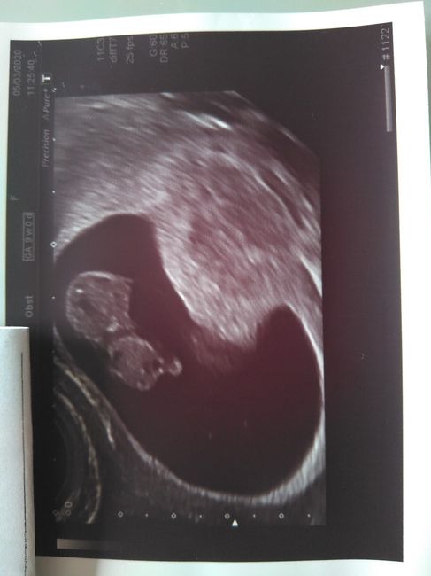 Futuras mamas octubre 2020 - 1