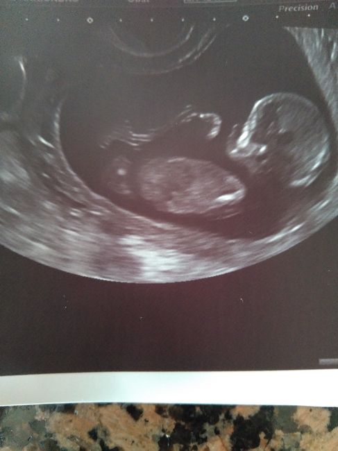 Futuras mamas octubre 2020 - 1