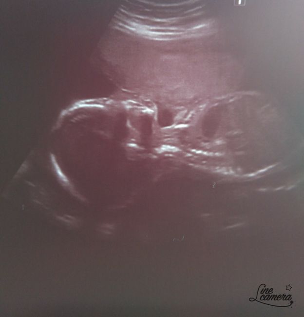 Futuras mamas octubre 2020 - 1