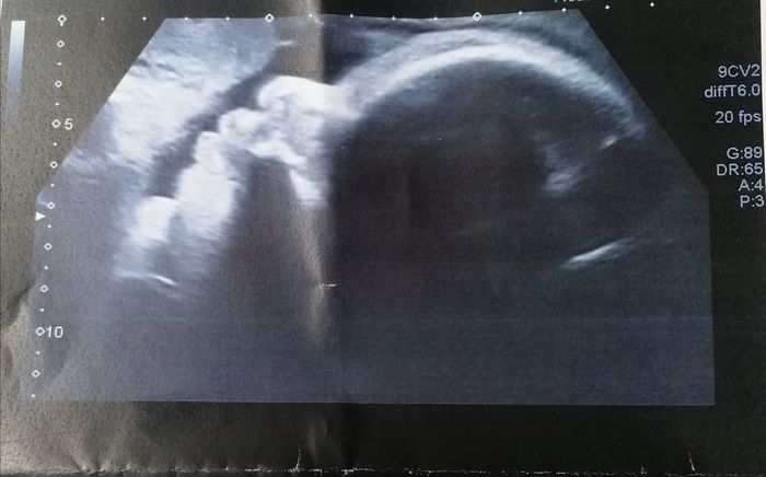 Futuras mamas octubre 2020 - 1