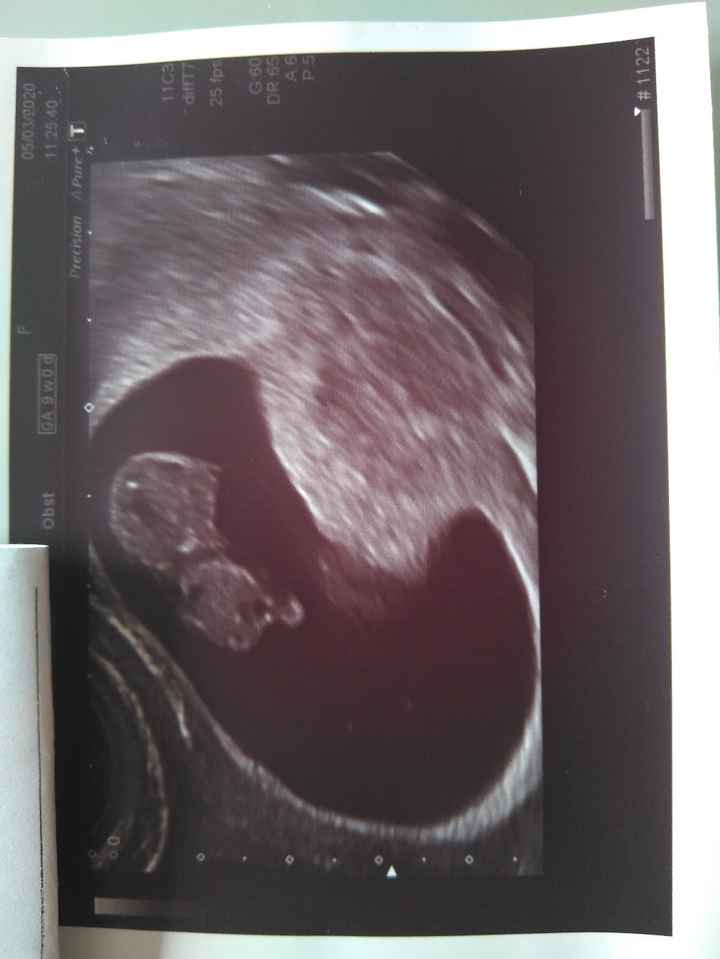Futuras mamas octubre 2020 - 1
