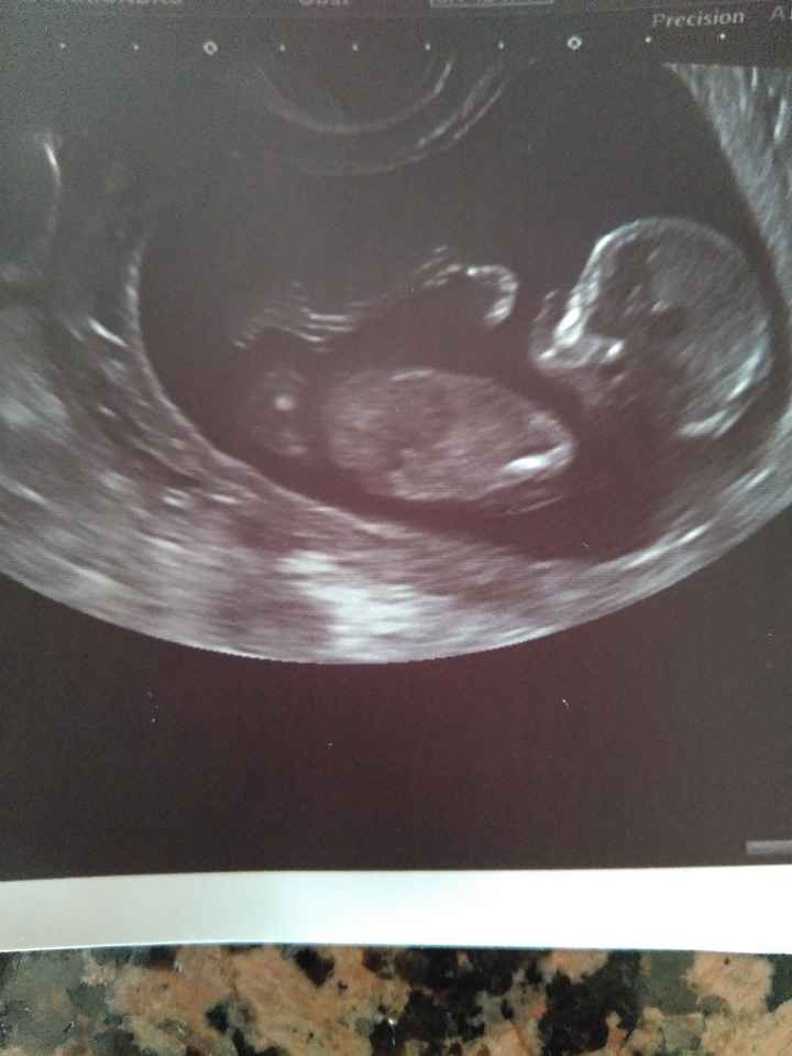 Futuras mamas octubre 2020 - 1