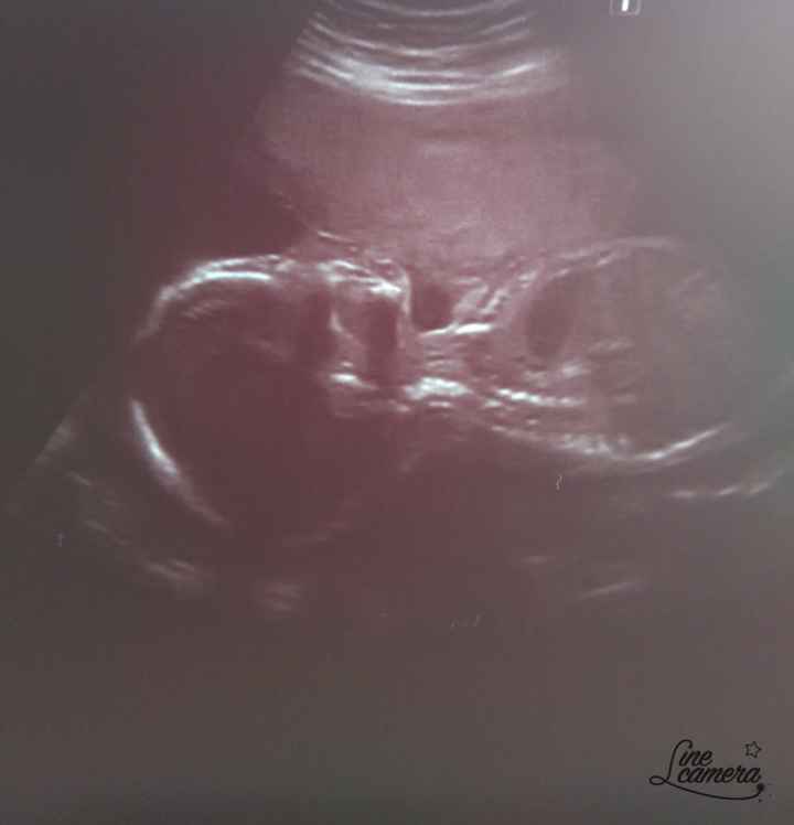 Futuras mamas octubre 2020 - 1