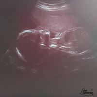 Futuras mamas octubre 2020 - 1