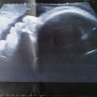 Futuras mamas octubre 2020 - 1