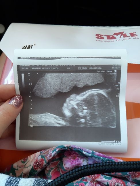 Futuras mamas octubre 2020 - 1