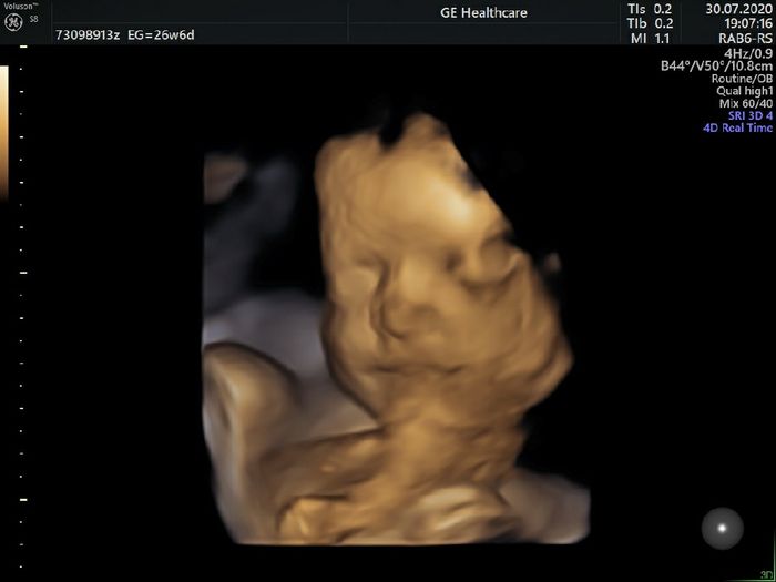 Futuras mamas octubre 2020 - 1