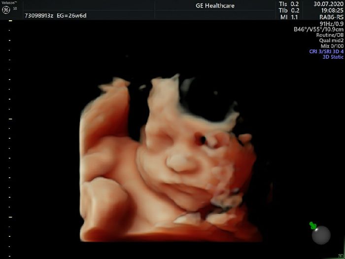 Futuras mamas octubre 2020 - 2