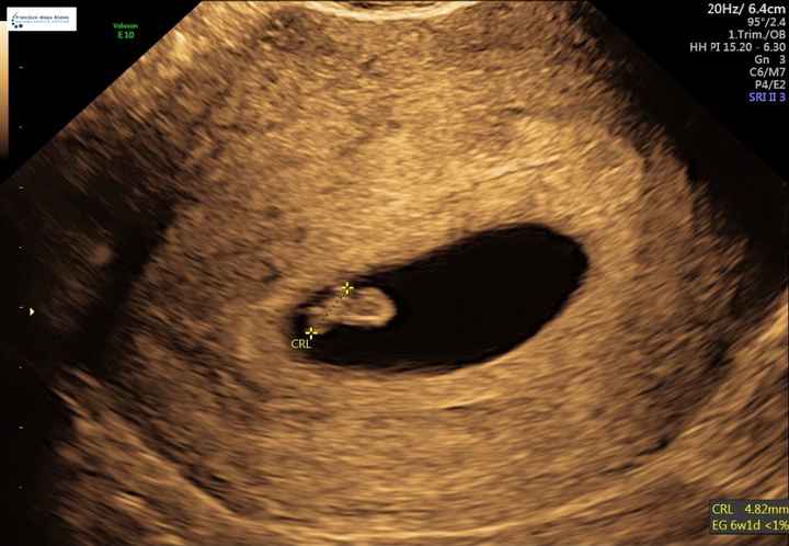 Mamas Marzo 2020 - 1