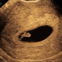 Mamas Marzo 2020 - 1