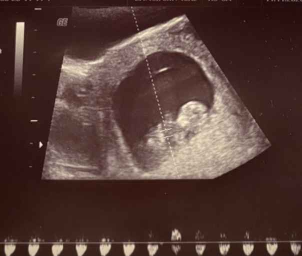 Futuras mamis junio 2021 🤰🏻❤️ oficial - 1