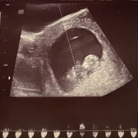 Futuras mamis junio 2021 🤰🏻❤️ oficial - 1