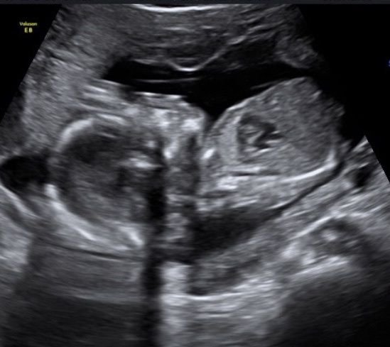 Futuras mamis Febrero 2021 - 1