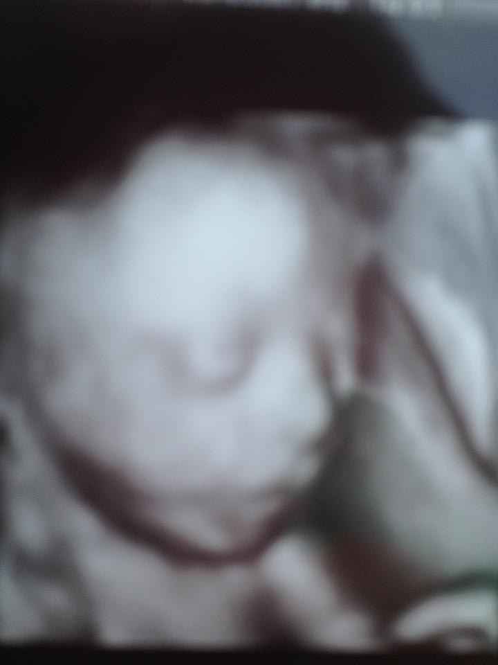 Bb. Eco 3D 