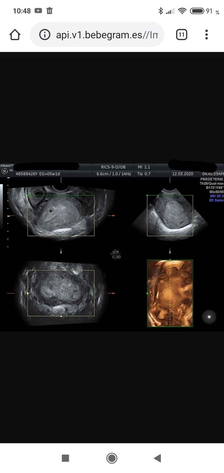 Futuras mamas noviembre 2020 - 2