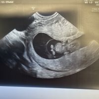 Futuras Mamás Noviembre y Diciembre - 1